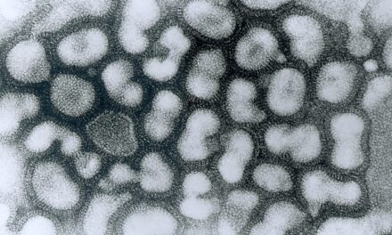 Vajdaságban regisztrálták az első A típusú influenzás esetet