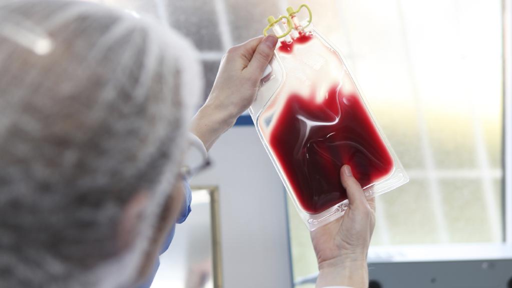 Elhunyt a vérátömlesztés során HIV-fertőzést kapott nő