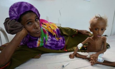 85 000 gyermek halt éhen Jemenben