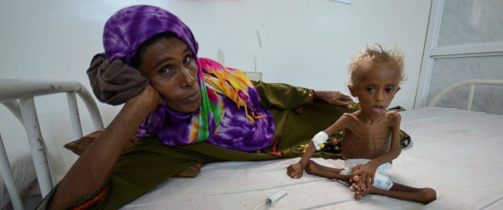 85 000 gyermek halt éhen Jemenben