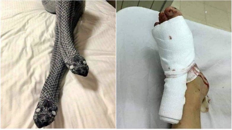 Meg akarta lepni a férjét az új harisnyával, de az cserébe eltörte a lábát