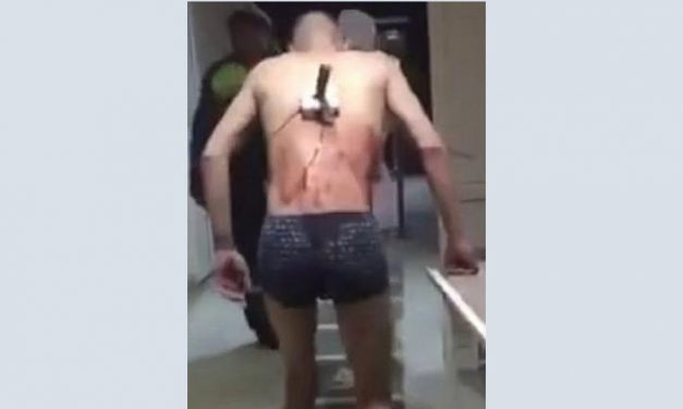 Egy férfi késsel a hátában csoszogott ki a kórházból, hogy rágyújthasson (VIDEÓ)