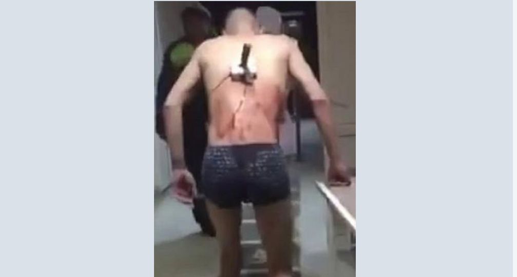 Egy férfi késsel a hátában csoszogott ki a kórházból, hogy rágyújthasson (VIDEÓ)