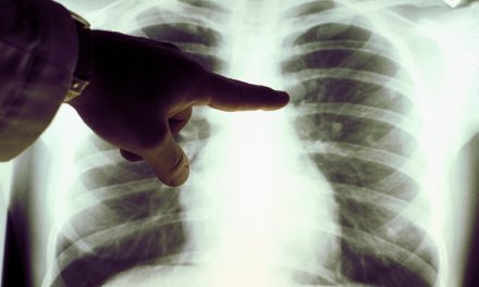 Naponta tizenhárom szerbiai meghal tüdőrákban