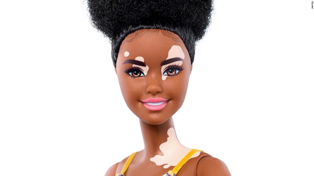 Bőrbeteg és haj nélküli Barbie babával bővítette kínálatát a Mattel