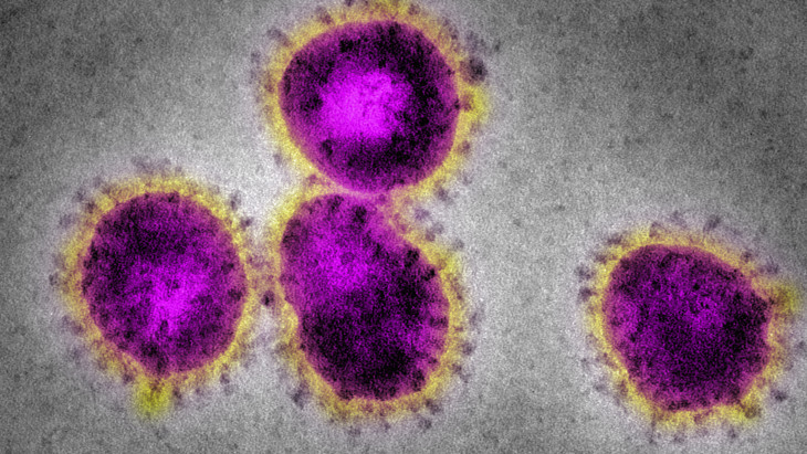 Francia kutatóknak sikerült izolálniuk és sejtkultúrába oltaniuk az új koronavírus törzseit