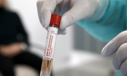 Szerbiában jelenleg több mint kétszázezer koronavírus-teszt van raktáron