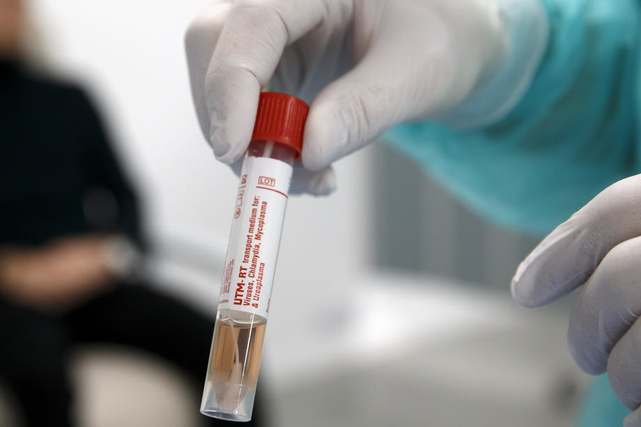 Szerbiában jelenleg több mint kétszázezer koronavírus-teszt van raktáron