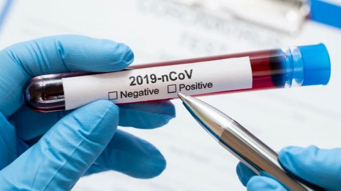 Tegnap óta 96 új koronavírus-fertőzött Szerbiában