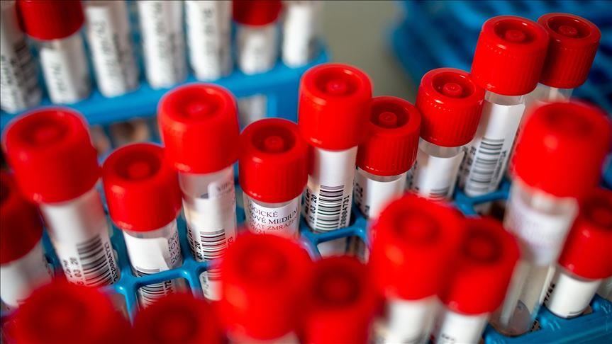 Szerbiában 99 új koronavírusos esetet regisztráltak