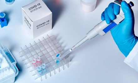 Két szegedi cég is felfüggesztette a PCR-tesztelést