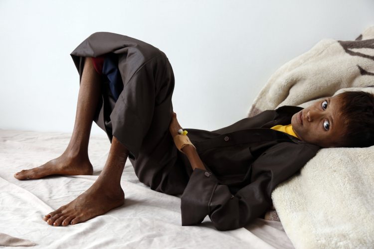 Továbbra is milliókat fenyeget az éhínség Jemenben