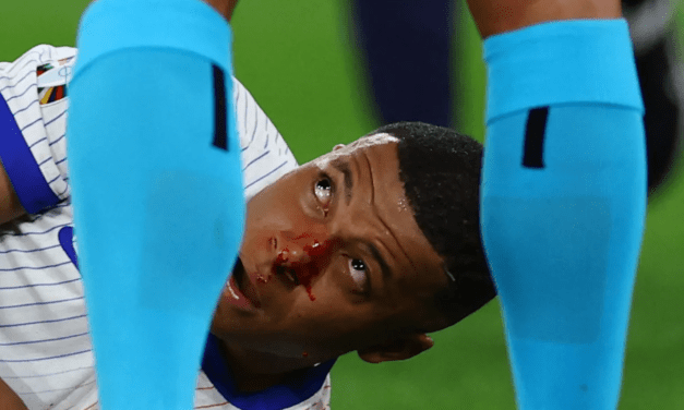 Eltörött Mbappé orra, de nem kell megműteni