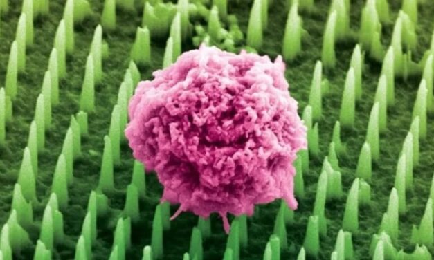 Fájdalommentessé teszi a biopsziát az új orvosi csodatapasz